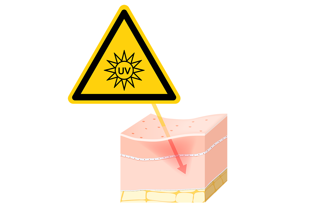 uv-light-skin-damage-2